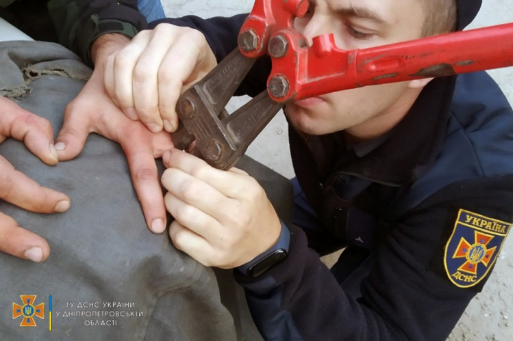 У Дніпрі зрізали каблучку з пальця чоловіка